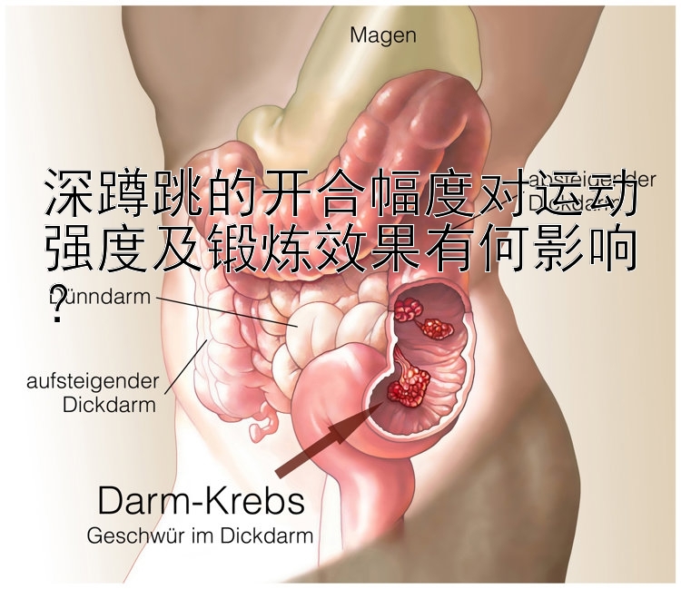 深蹲跳的开合幅度对运动强度及锻炼效果有何影响？