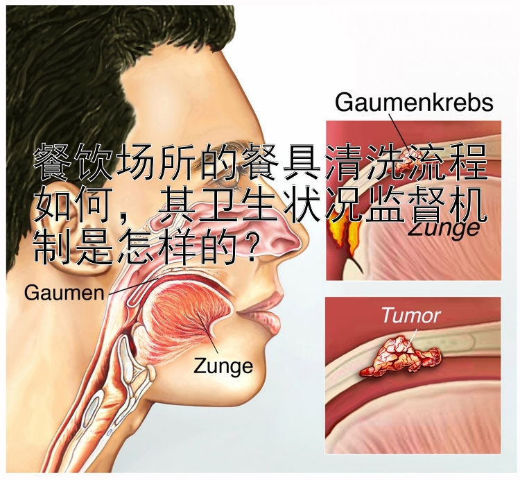 餐饮场所的餐具清洗流程如何，其卫生状况监督机制是怎样的？