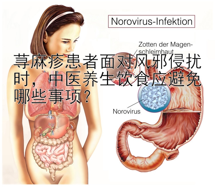 荨麻疹患者面对风邪侵扰时，中医养生饮食应避免哪些事项？