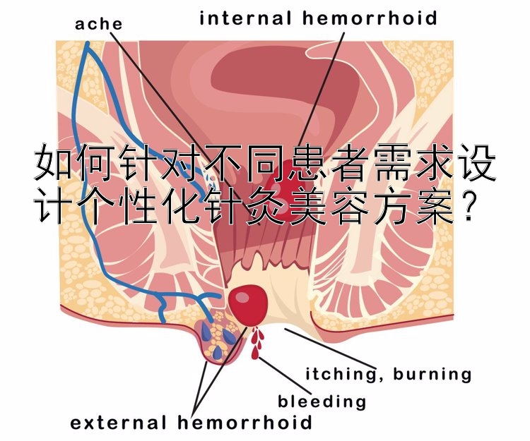 如何针对不同患者需求设计个性化针灸美容方案？